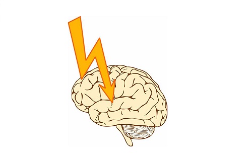 脑卒中出现症状及处理方法