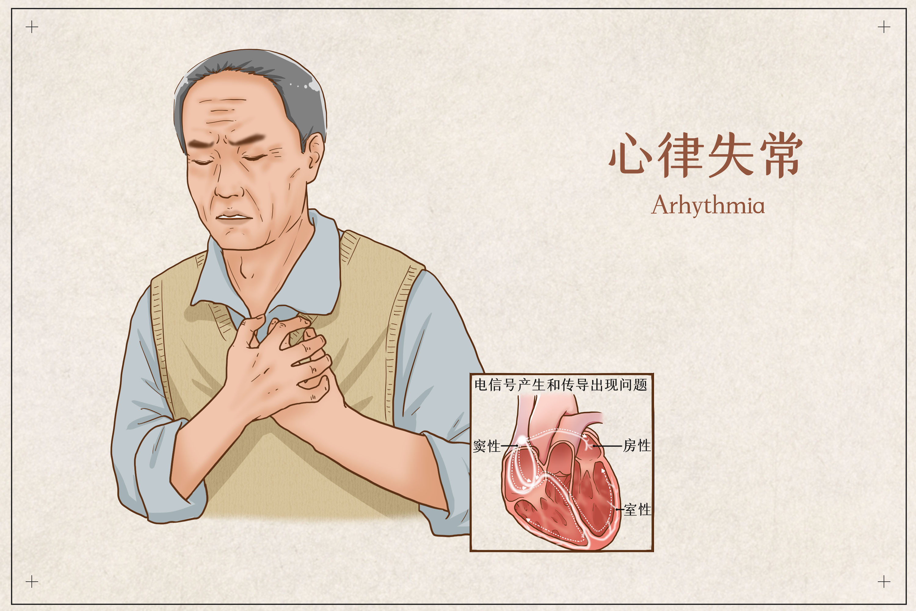 高血压与室性心律失常有关吗？