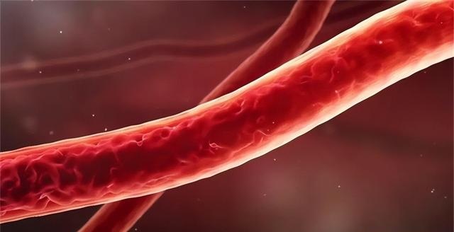 不止于降脂：对抗缺血性卒中，要瞄准oxLDL